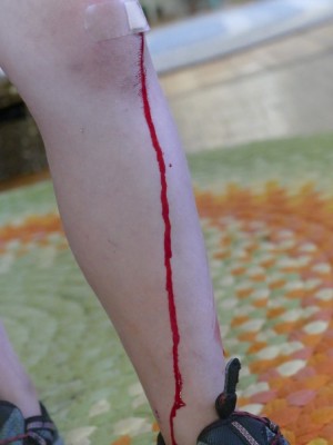 blood dripping down Harvey's leg