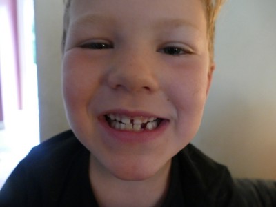 Elijah smiling to show the space where his third tooth fell out